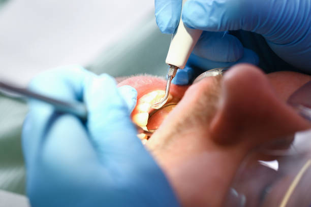Best Same-Day Emergency Dentist in Waverly, VA